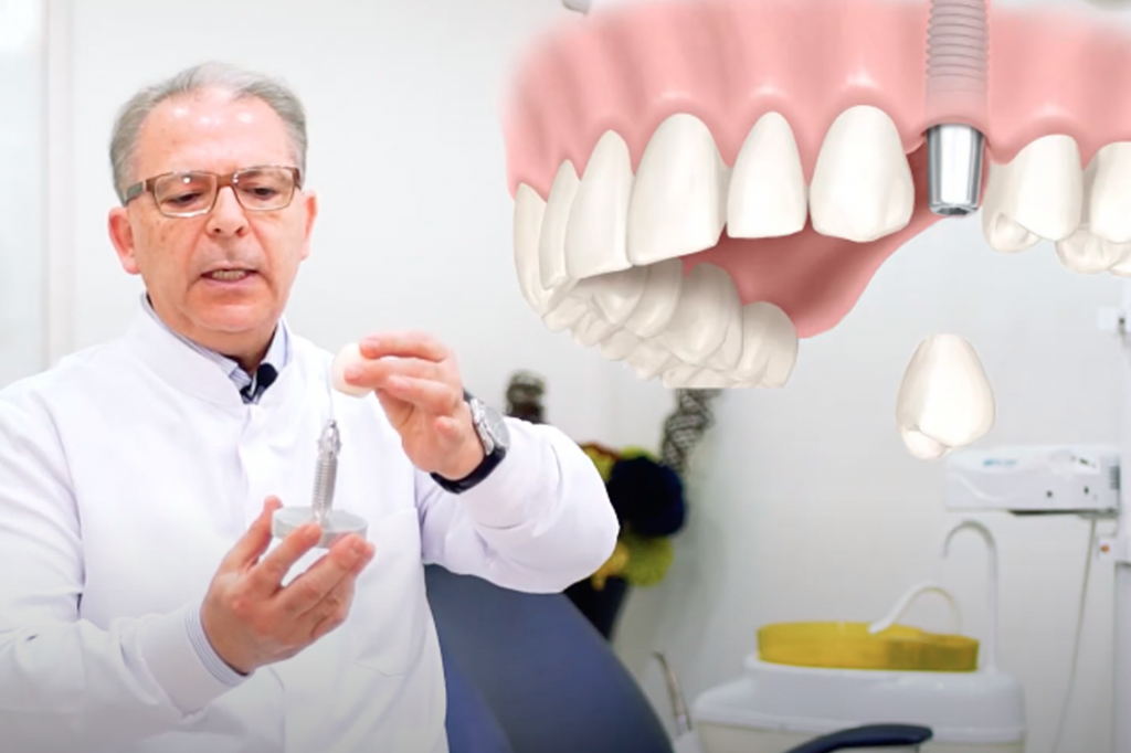 Implantes e Próteses Odontologia Futura